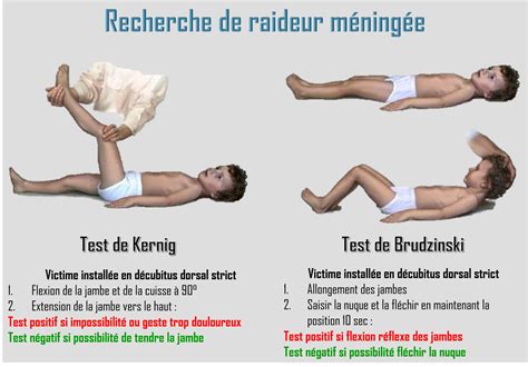 Le Scope Il Existe Deux Tests Daide Au Diagnostic De M Ningite