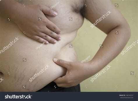 Nude Stretch Marks Telegraph