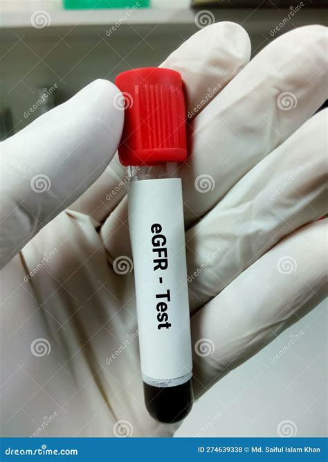 Blood Test For Glomerular Filtration at Alyssa Dalziel blog