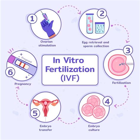 A Guide To The Steps Involved In The IVF Process Ritu IVF