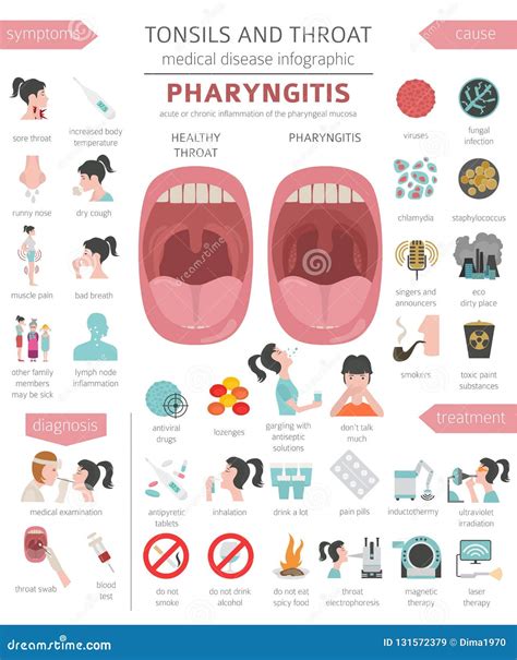 Am Gdalas Y Enfermedades De La Garganta S Ntomas De La Faringitis