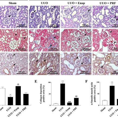 Prf Relieves Glomerular Damage And Decreases Collagen Deposition In