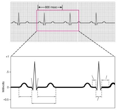 Ekg Interval Waves And Segments Diagram Quizlet