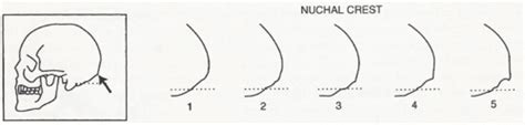 Sex Estimation Flashcards Quizlet