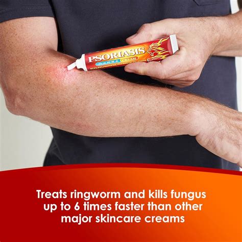 20g Itching Cream | Anti Itch Relief Treatment for Dry Skin Rashes