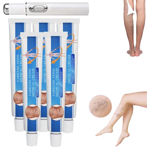 Buy Venoheal Varicose Vein Cream Veins Relie Cream Anti Varicose Veins For Legs Varicose Vein