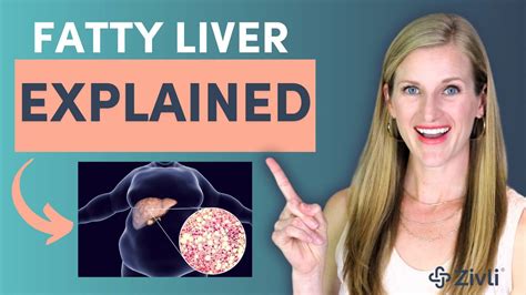 Fatty Liver Disease & Diet Explained