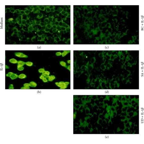 Botanical extracts inhibit IL 1β induced nuclear translocation of NF κB