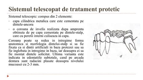 Tratamentul ortopedic al pacienților cu migr pptx