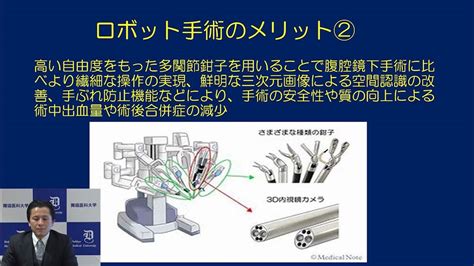 産婦人科領域におけるロボット手術：産科婦人科 助教 入江 太一 Youtube