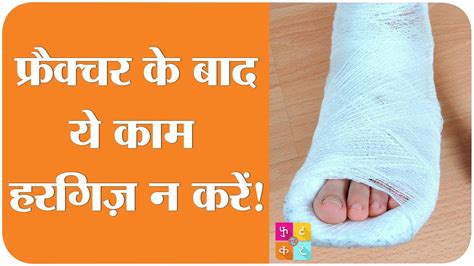 Bones Fracture के बाद हड्डियों को हेल्दी कैसे बनाएं Tan Ki Baat