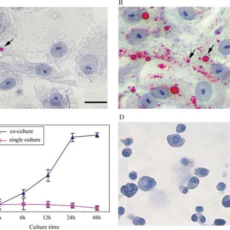 Comparison Of Lipid Droplet Formation In Sertoli Cells At Different