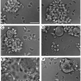 Scanning electron micrographs of syncytia (S) with surrounding ...