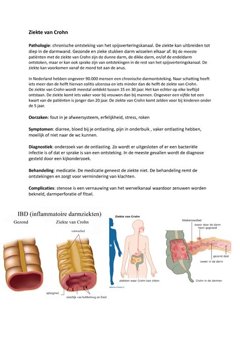 Ziekte Van Crohn Ziekte Van Crohn Pathologie Chronische Ontsteking