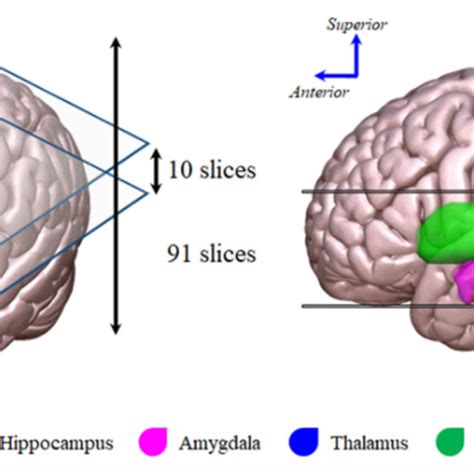 Slices Of Interest Including The Hippocampus Amygdala Thalamus And