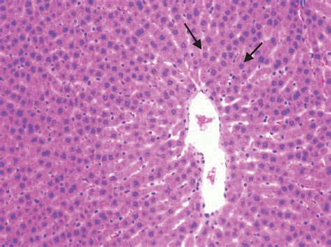 Histopathological Section Photographs Of Rat Liver Tissue Slices For Download Scientific