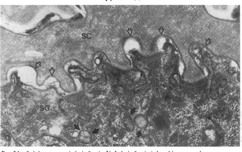 Figure 7 From The Aged Epidermal Permeability Barrier Structural