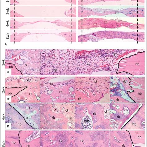 Histological Evidence For Enhanced Bone Regeneration By Rcp Download Scientific Diagram