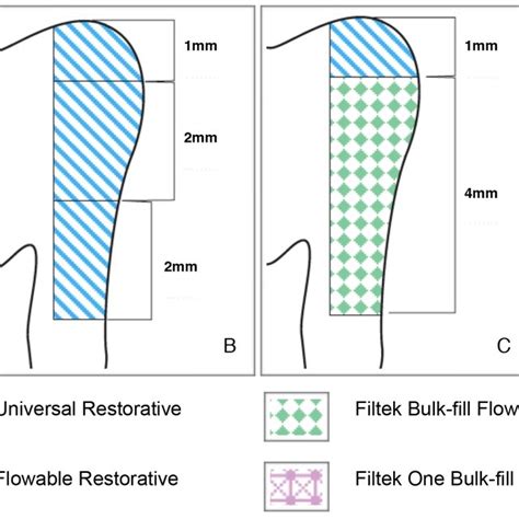 Representative Figures Of Restorative Procedure A Flowable Composite Download Scientific