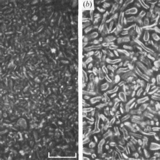 Dark Field Phase Contrast Microscopy Of Isolated Cell Walls O F T