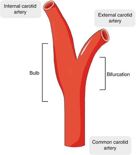 Common Carotid Artery Bifurcation