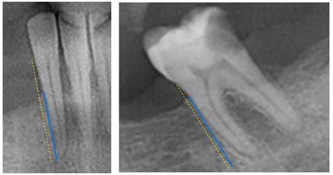 Analyzing Oral Health Conditions In Sex Workersa Comparative