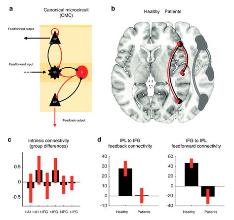 Dysconnection In Neglect Patients Between Parietal And Frontal Cortex Download Scientific