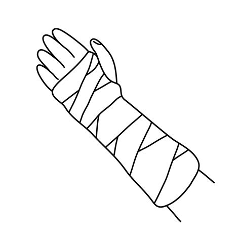 Иллюстрация гипсовой повязки на сломанной руке | Премиум векторы