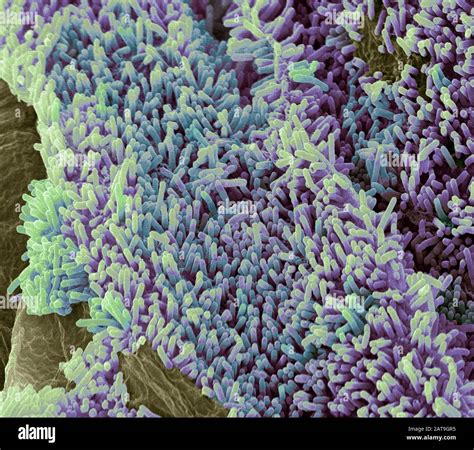 Microscopic Image Bacteria Hi Res Stock Photography And Images Alamy