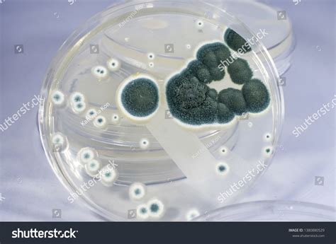 Colonies Penicillium Fungi Grown On Sabouraud Stock Photo 1380880529