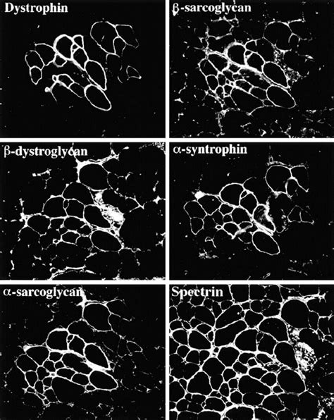 Expression Of Dystrophin And Dystrophin Associated Glycoprotein Complex