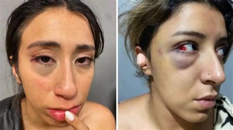 Tucum N Violento Dos Hermanas Fueron Atacadas Por Una Patota A La