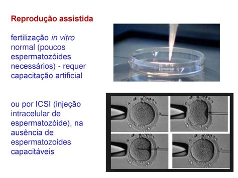 Fertiliza O E Fatores Que Contribuem Infertilidade Ppt Carregar