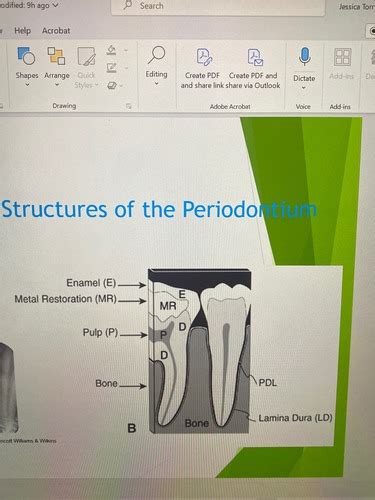 Clinical Periodontal Assessment Flashcards Quizlet