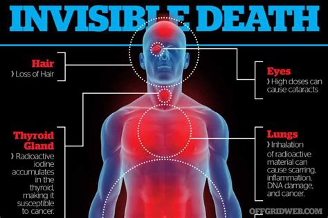 Symptoms Of Radiation Poisoning Symptoms Of Radiation Poisoning