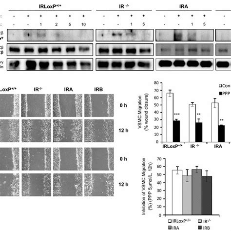 Igf Ir Contributes To Basal Vsmc Migration A Effect Of Ppp Igf Ir