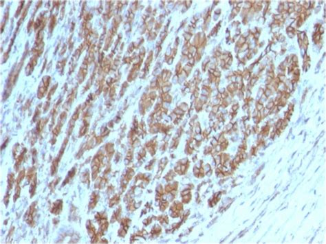 Catenin, beta (p120) Monoclonal Antibody (CTNNB1/2098) (1499-MSM11-P1ABX)