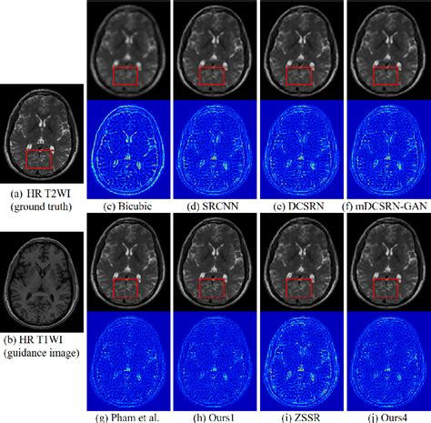 [pdf] Unsupervised Mri Super Resolution Using Deep External Learning And Guided Residual Dense