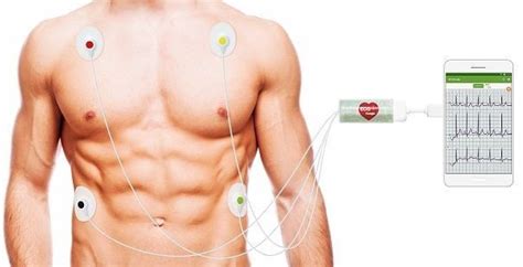 Кардиофлешка ECG Dongle (портативный кардиокомплекс) в продаже в ...