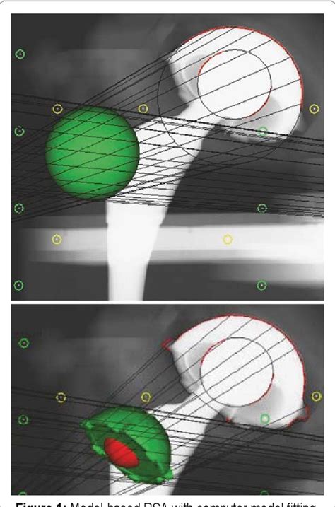 Figure 1 From Polyethylene Finite Element Wear Simulation Evaluated By