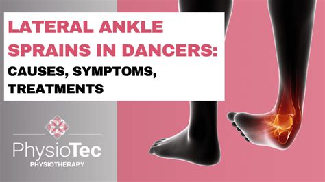 En Pointe Common Foot Injuries In Ballet Dancers Physiotec