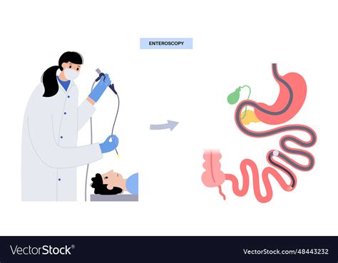 Esophagogastroduodenoscopy medical procedure Vector Image