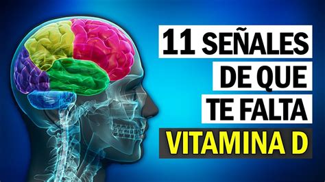 11 Síntomas de que Te Falta Vitamina D CUIDADO YouTube