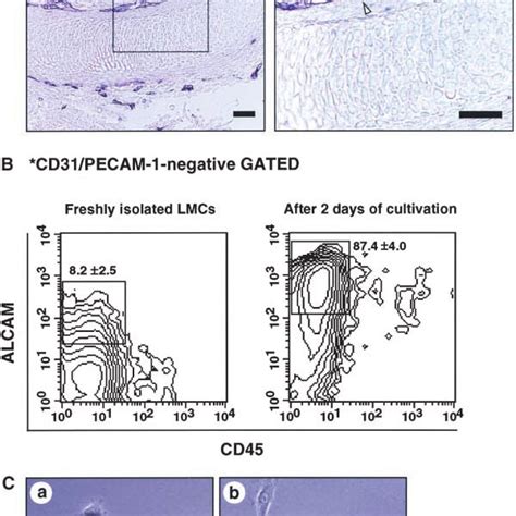 Perichondrial Cells Express Alcam A Longitudinal Sections Of E135 Download Scientific