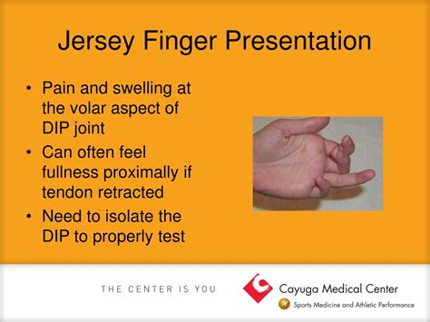 Ppt Common Hand And Wrist Injuries Powerpoint Presentation Free