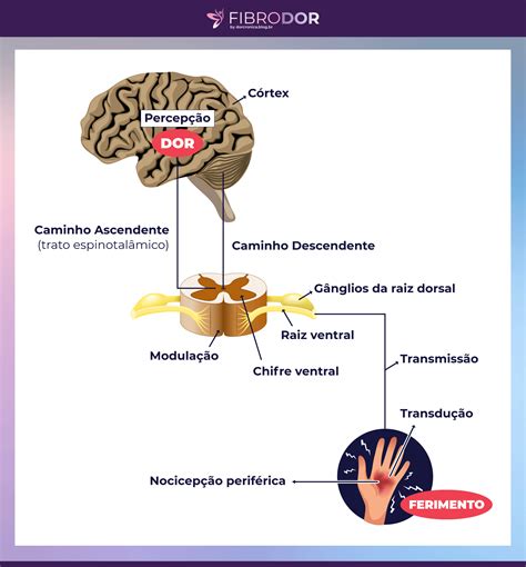 Dor Neuropática E Fibromialgia