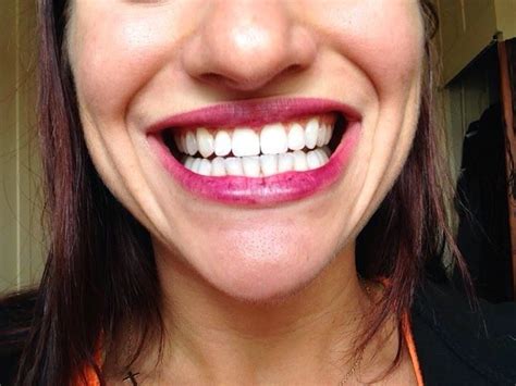 From Flab To Fab Whiten Your Teeth In 5 Minutes With Activated