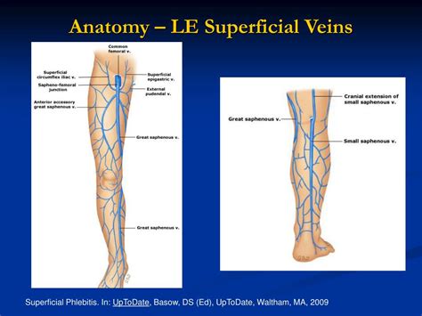 Ppt Superficial Venous Thrombophlebitis To Treat Or Not To Treat Evidence Behind The 2008