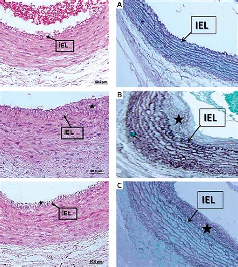 Figure 1 From Effect Of N Acetylcysteine On Intimal Hyperplasia And