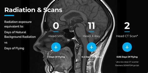 CT Scan Radiation X Ray Radiation Safety Guide